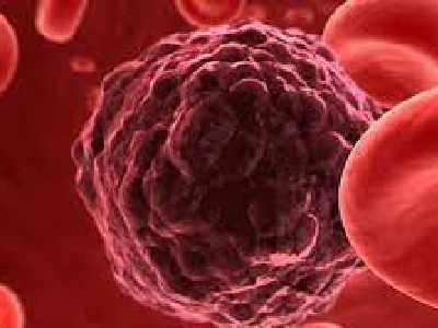 Oncology Treatment In Chile